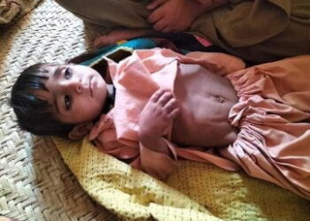 7/10 mothers die in Balochistan during child birth, while children are suffering from Malnutrition disorders